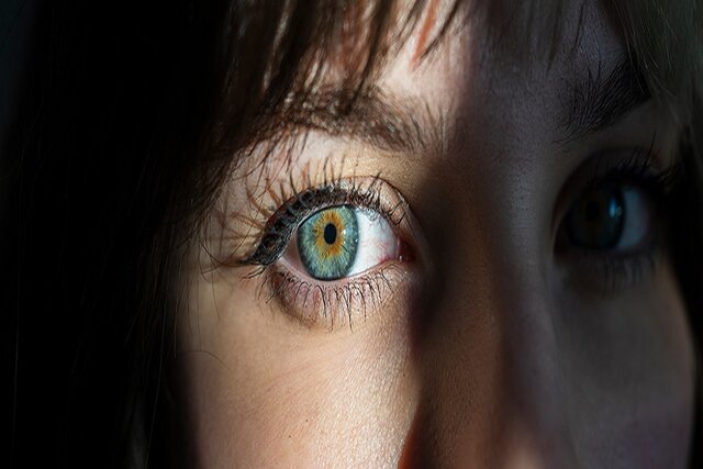 ریسک زخم قرنیه و عفونت چشم با مژه مصنوعی و لنز