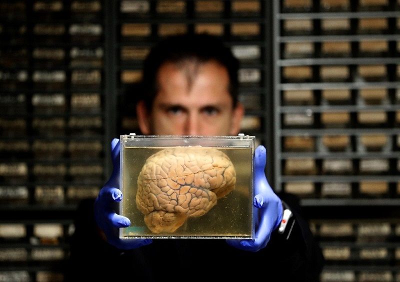 به گفته محققان مغز پولدارها دیرتر پیر می‌شود