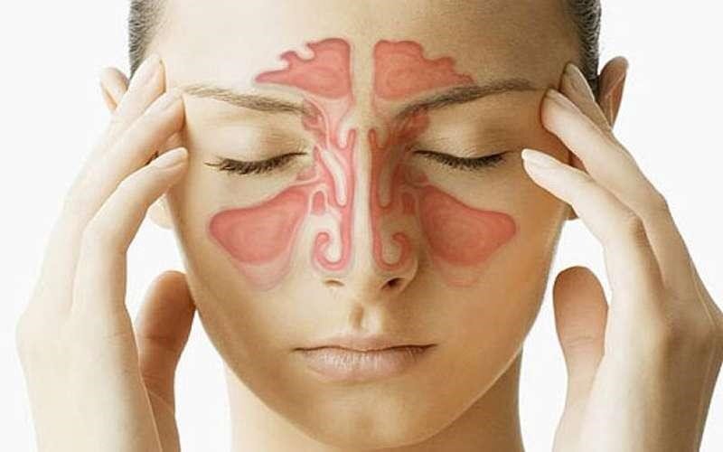 درمان خانگی سینوزیت؛ راه‌هایی طبیعی برای نفس راحت