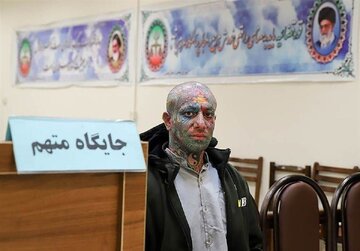آخرین خبر از وضعیت تتلو