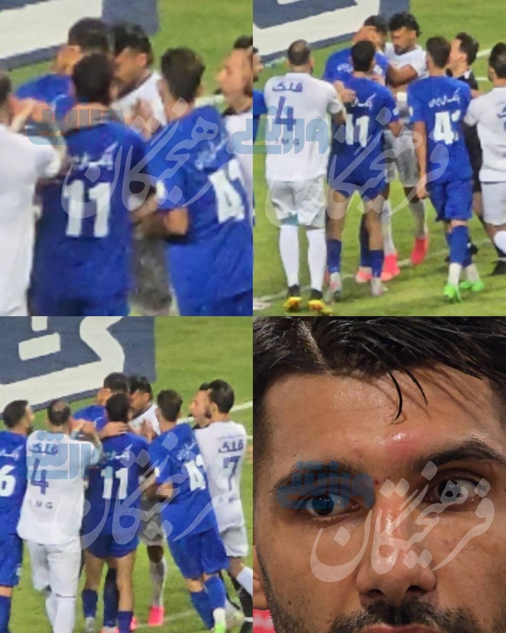 رد پای ضربه خشن رضاییان روی صورت بازیکن استقلال خوزستان + عکس