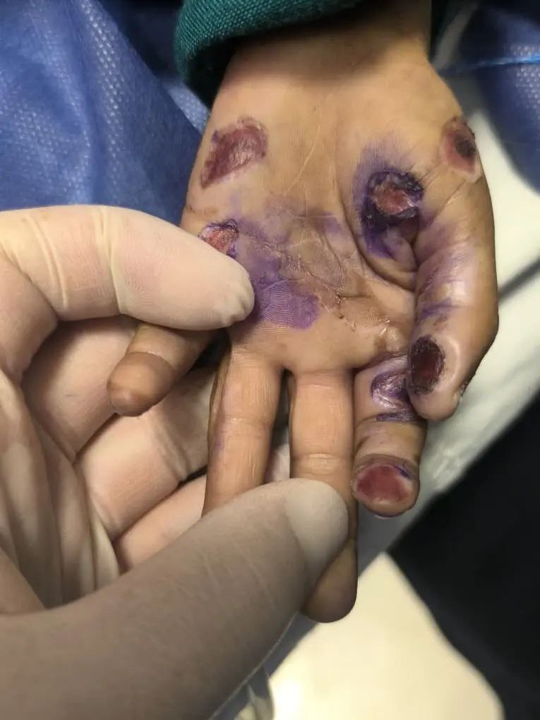 جزئیات تکان دهنده فوت یک کودک ۴ساله در پی آزار و اذیت