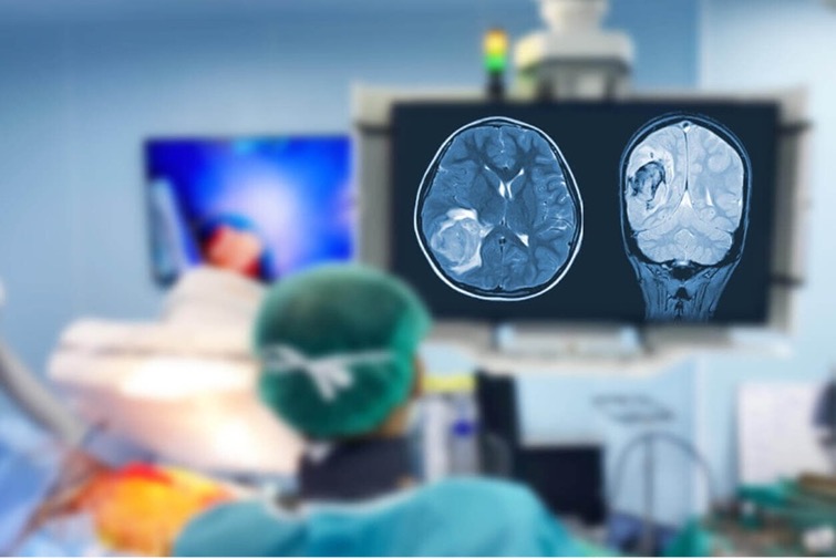 جراحی مغز | از تشخیص تا انتخاب بهترین جراح
